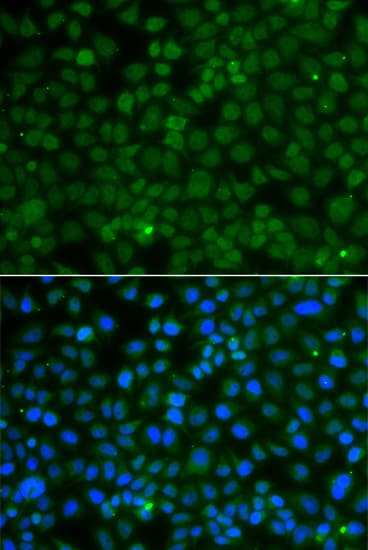 WDR45 Antibody