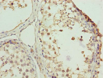 ZNF131 Antibody