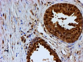 PSMB9 Antibody (clone OTI2B6)