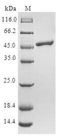 Human TCAP / Telethonin Protein (Recombinant GST, N-terminus)
