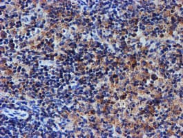 Monoclonal Mouse anti-Human UNG / Uracil DNA Glycosylase Antibody (clone OTI1G1, IHC, IF, WB)