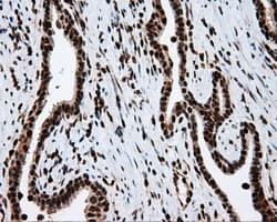 Monoclonal Mouse anti-Human ACLY / ATP Citrate Lyase Antibody (clone 3G8, Carrier-free, IHC, IF, WB)