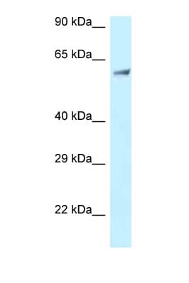 Polyclonal Rabbit anti-Human CLINT1 Antibody (aa229-278, WB)