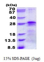 Human BTF3 Protein (Recombinant His)
