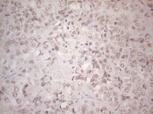 SPT3 / SUPT3H Antibody (clone OTI1A5)