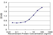 IHC-plus™ Monoclonal Mouse anti-Human ASAH1 / Acid Ceramidase Antibody (clone 1A7, IHC, WB)