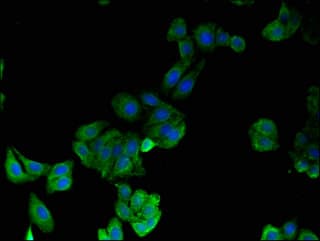 Polyclonal Rabbit anti-Human 15-PGDH / HPGD Antibody (IHC, IF)