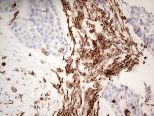 ANPEP / CD13 Antibody (aa668-967, clone OTI2E4)