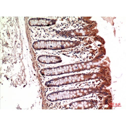 ITGA5/Integrin Alpha 5/CD49e Antibody (561-610 aa, Internal)