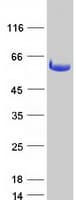 Human DDX19A Protein (Recombinant Myc-DDK (Flag))