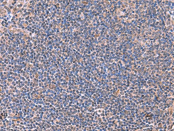 PEPD / PROLIDASE Antibody