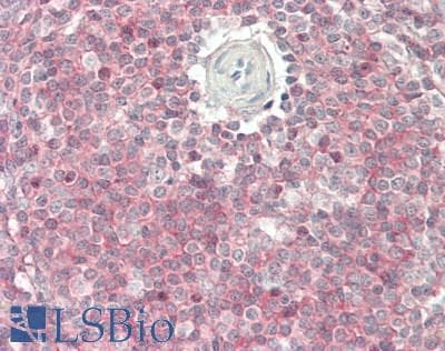 IHC-plus™ Polyclonal Rabbit anti-Human TRPV4 Antibody (Internal, IHC, WB)