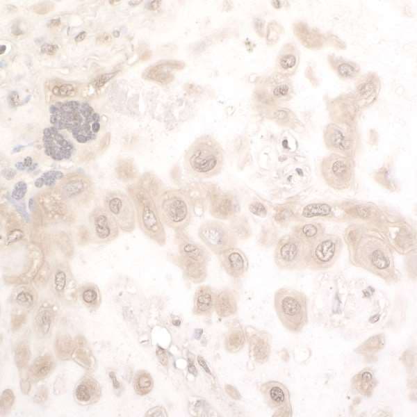 NAMPT / Visfatin Antibody (aa400-450)