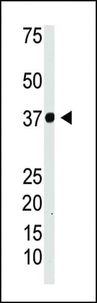 NFKBIA / IKB Alpha / IKBA Antibody (aa1-30)