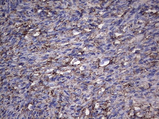 PKM2 Antibody (clone 14C7)