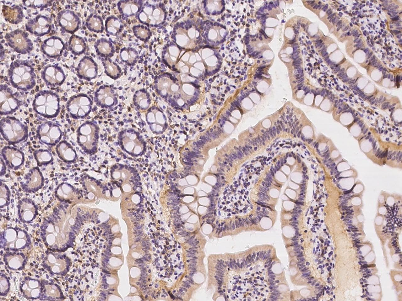 AFG3L2 Antibody