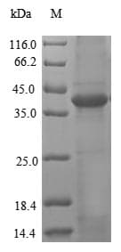 Mouse LGMN / Legumain Protein (Recombinant 6His, N-terminus)