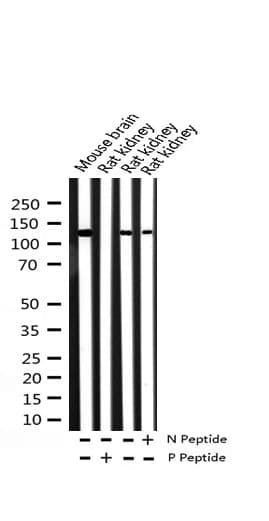 GRIN1 / NMDAR1 Antibody (phospho-Ser897)