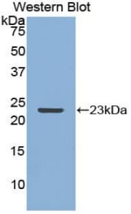 MMP12 Antibody (aa286-464)