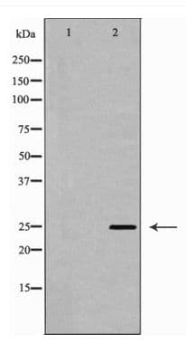 Polyclonal Rabbit anti-Human SOD2 / Mn SOD Antibody (WB)