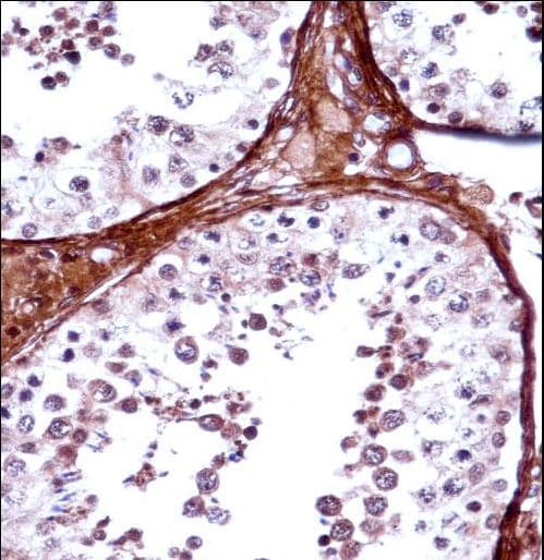 TBX5 Antibody (aa1-30)