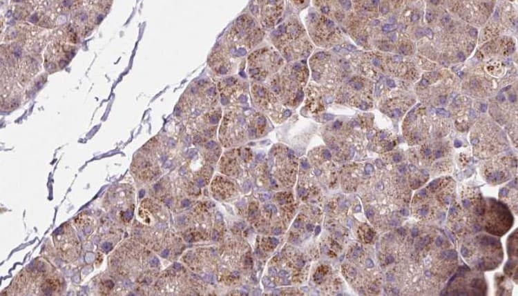 SLC39A6 / LIV-1 Antibody