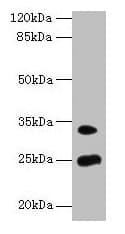 Polyclonal Rabbit anti-Human MREG Antibody