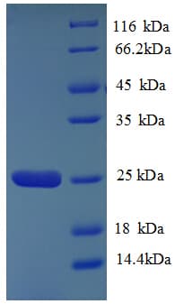 Human HLA-DQA2 Protein (Recombinant His)