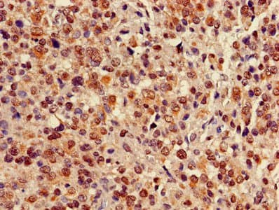 Polyclonal Rabbit anti-Human CBX5 / HP1 Alpha Antibody (IHC, WB)