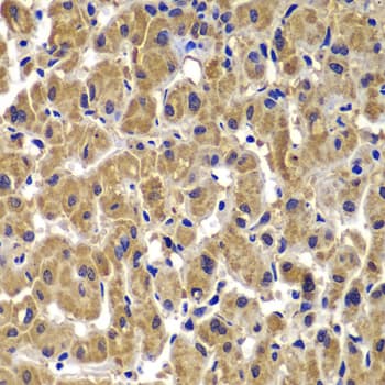 Polyclonal Rabbit anti-Human MMP14 Antibody (IHC, WB)