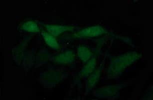 Placental Lactogen Antibody (clone OTI2A2)