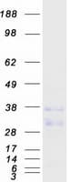 Human MENT / C1orf56 Protein (Recombinant Myc-DDK (Flag))