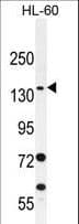 SPECC1 / CYTSB Antibody (aa705-733)