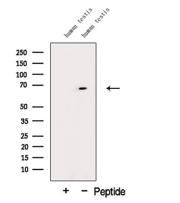 DTX2 Antibody