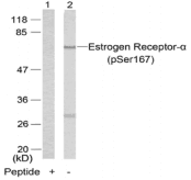 Polyclonal Rabbit anti-Human ER Alpha / Estrogen Receptor Antibody (IHC, IF, WB)