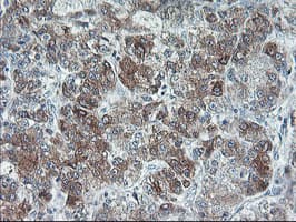 UCHL1 / PGP9.5 Antibody (clone OTI2B5, Carrier-free)