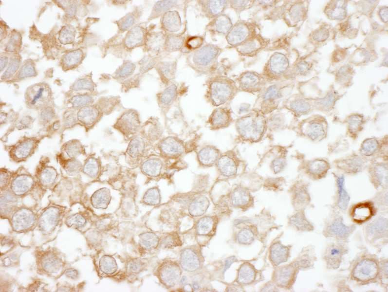 DGKZ Antibody (aa1067-1117)