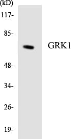Rhodopsin Kinase / GRK1 Antibody (aa17-66)