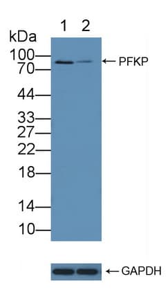 PFKP Antibody (aa553-753)