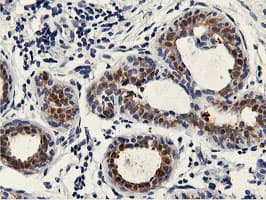 PNMT Antibody (clone OTI2F3)