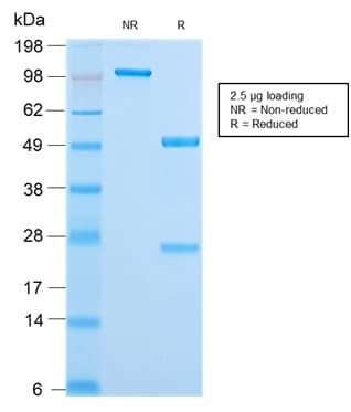 PathPlus™ Recombinant Monoclonal Rabbit anti-Human KRT18 / CK18 / Cytokeratin 18 Antibody (clone KRT18/2808R, IHC, IF, WB)