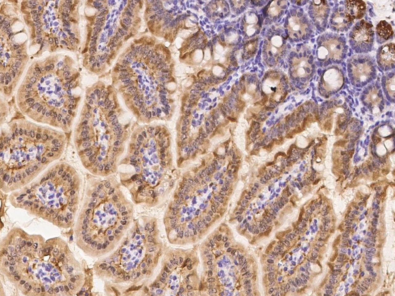 ZFP57 Antibody (Preservative Free)