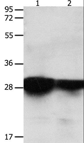 YWHAE / 14-3-3 Epsilon Antibody