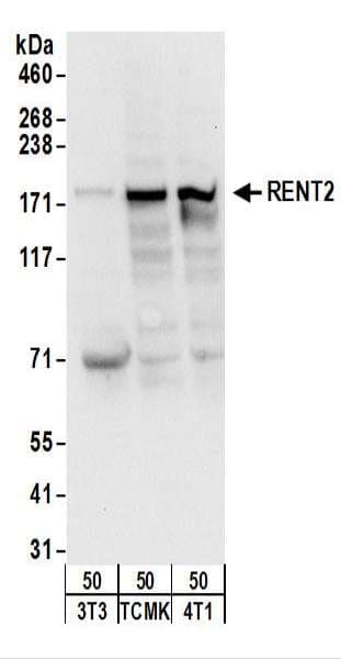 IHC-plus™ Polyclonal Rabbit anti-Human HUPF2 / UPF2 Antibody (aa1-50, IHC, WB)