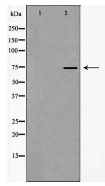 HNRPM / HNRNPM Antibody