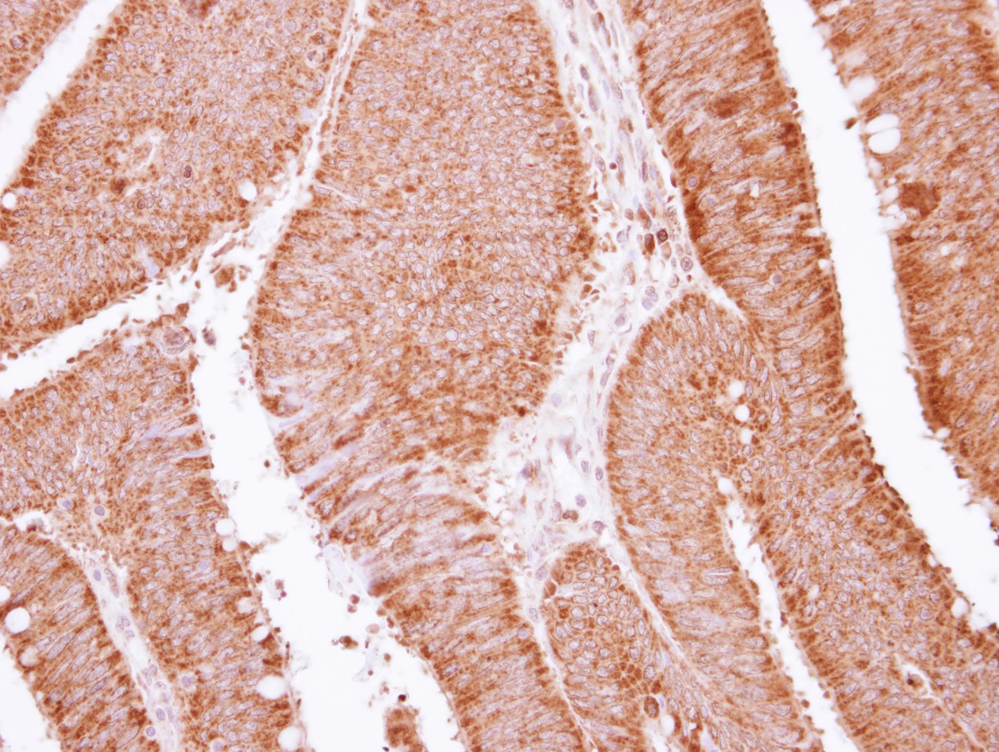 APOBEC3F / ARP8 Antibody