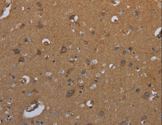Polyclonal Rabbit anti-Human ID2 Antibody (IHC)