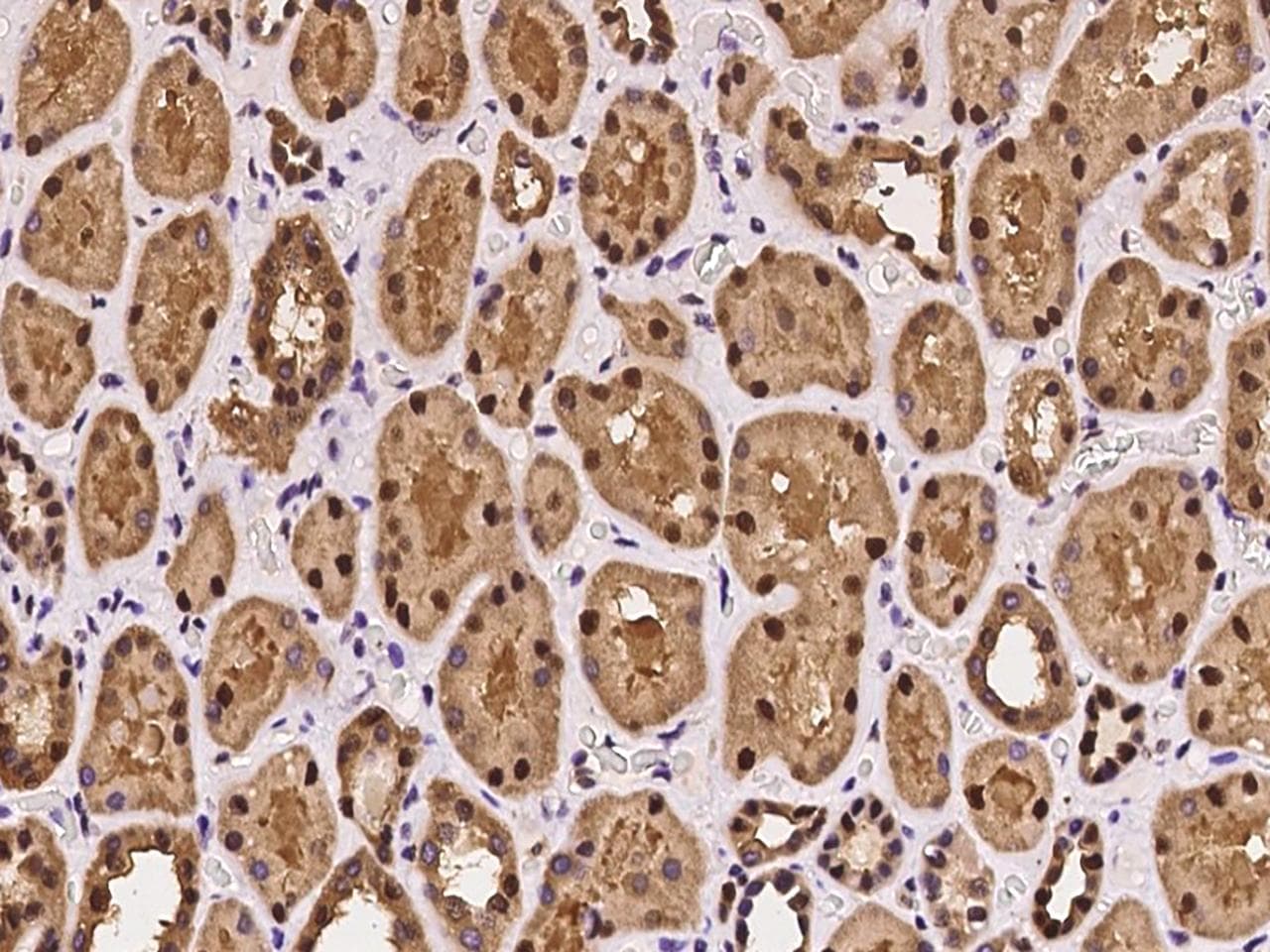 Polyclonal Rabbit anti-Human GSR / Glutathione Reductase Antibody (IHC)