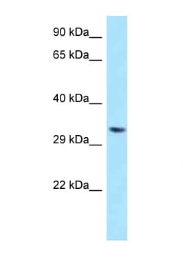 TWISTNB Antibody (aa176-225)