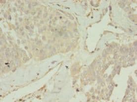 CCDC14 Antibody (Biotin)